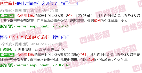 汕头孕妇几个月可以做四维彩超