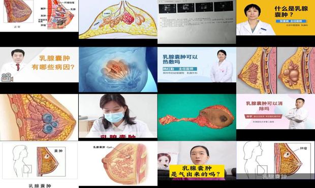 汕头乳腺*可以消除吗