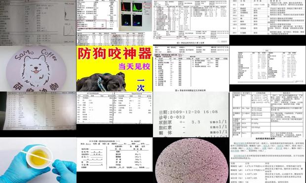 汕头检查尿rbc计数是什么