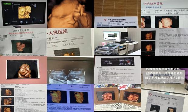 汕头四维彩超哪家好