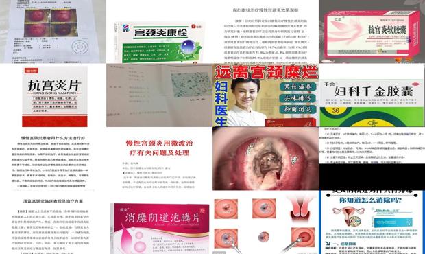 汕头治疗宫颈炎