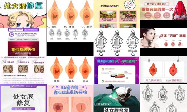 汕头处女膜修复