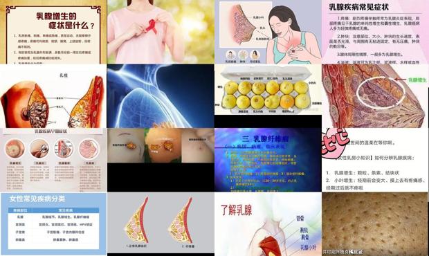 汕头常见的乳腺疾病有哪些