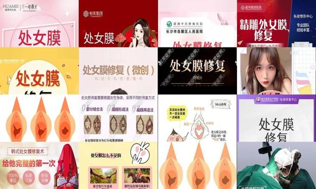 处女膜修复汕头