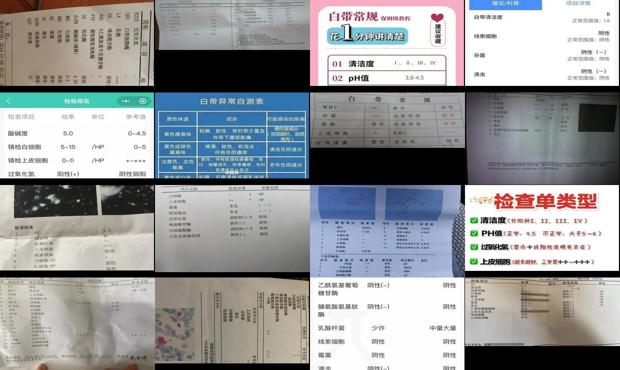 汕头幼师白带常规检查查什么