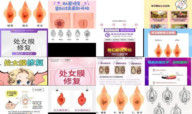 汕头修复处女膜