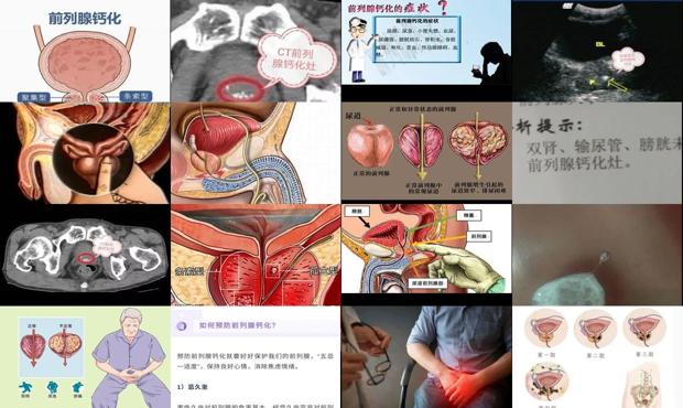 汕头妇科炎症吃什么药