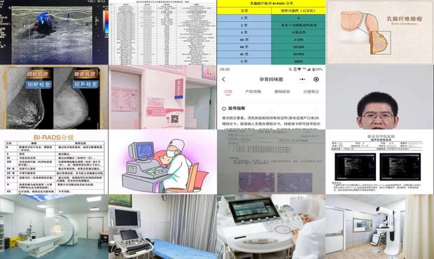 汕头乳腺b超检查多少钱