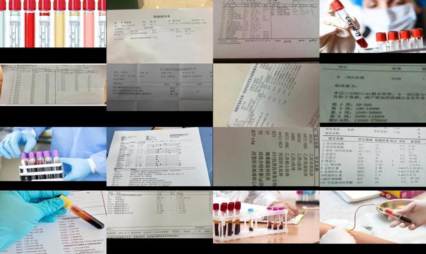 汕头血清可以检查出什么
