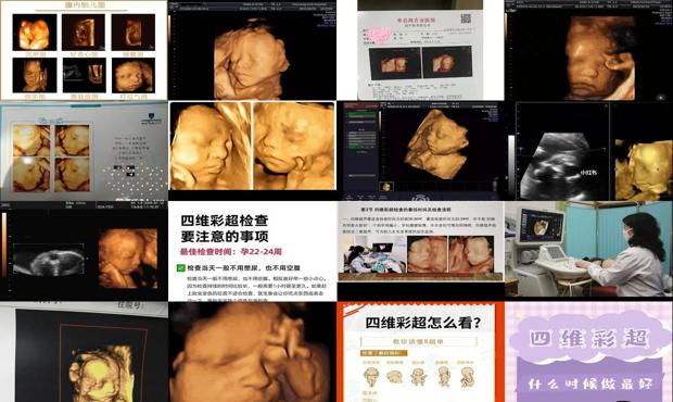 汕头胎儿四维什么时候做