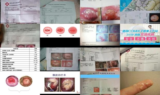 汕头治疗宫颈糜烂哪个医院好