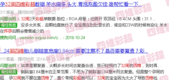 汕头怀孕32周四维彩超