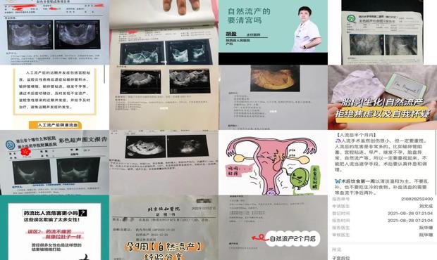 汕头自然流产后怎么判断要不要清宫