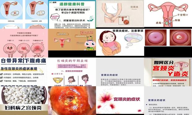 汕头宫颈炎的症状