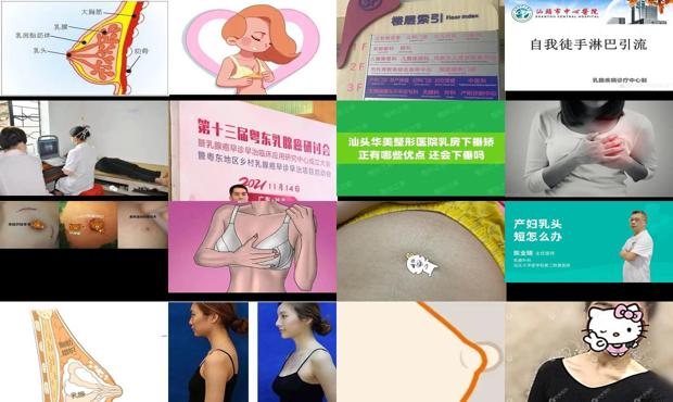 汕头乳腺长在哪儿