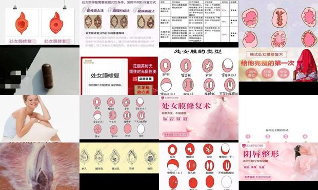 汕头修复处女膜要多少钱