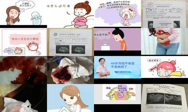 汕头流产一个多月了为何月经不来