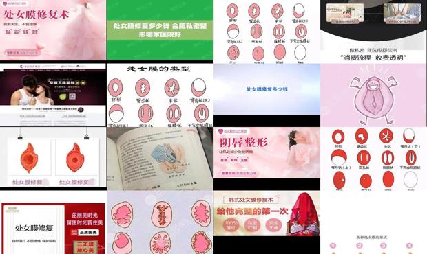 汕头处女膜修复多少钱