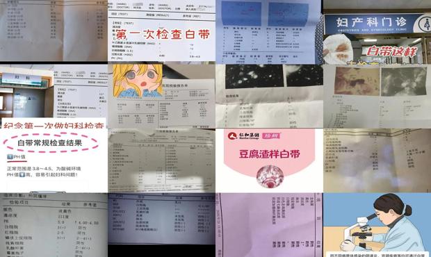 汕头怎么检查白带
