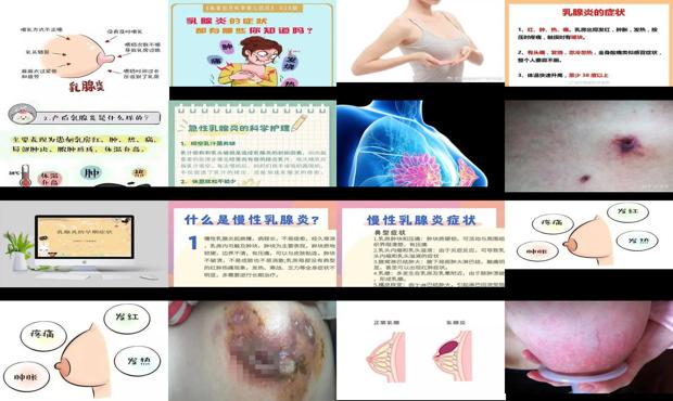 汕头得了乳腺炎的症状