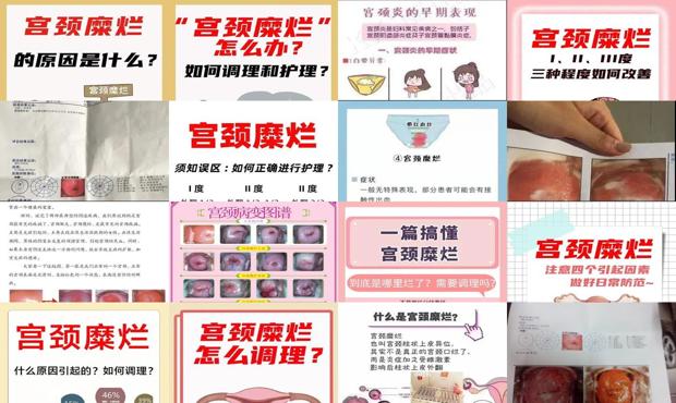 汕头宫颈糜烂怎么引起的