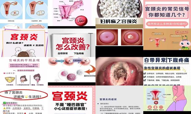 汕头宫颈炎有哪些症状