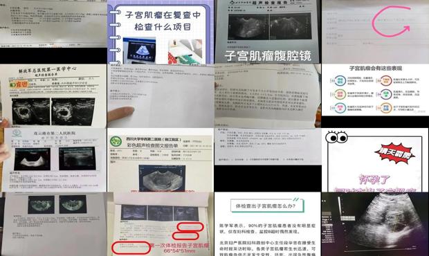 汕头体检查出子宫肌*怎么办