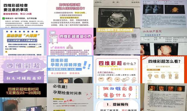 汕头四维的检查时间