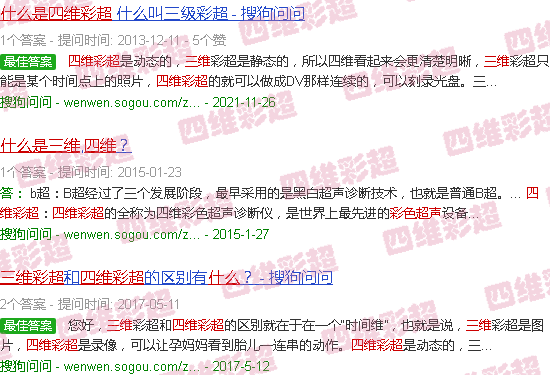 汕头什么是三维四维彩超