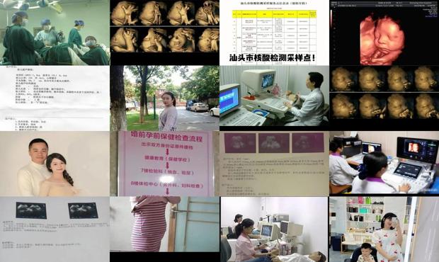 汕头怀孕5个月都检查什么
