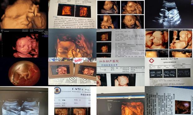 汕头四维彩超哪里好