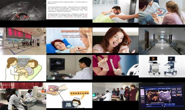 汕头检查妇科b超可以吃饭吗
