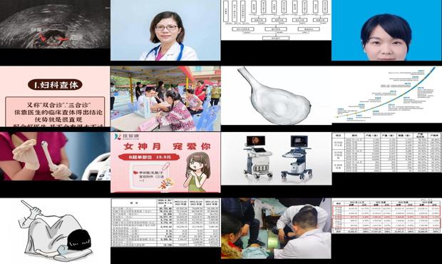 汕头妇科b超价格表