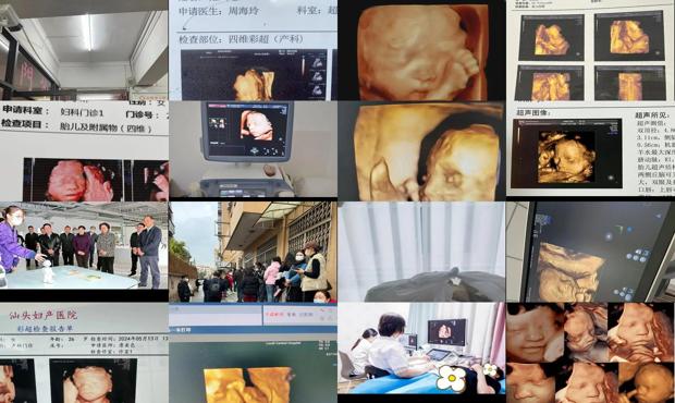 汕头四维是检查什么的