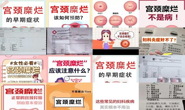 汕头宫颈糜烂怎样治