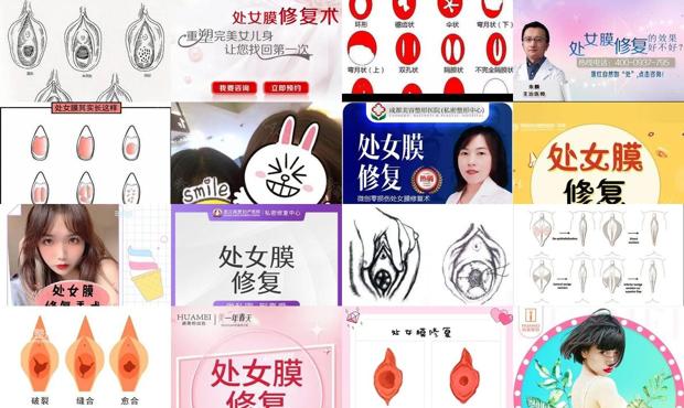汕头如何修复处女