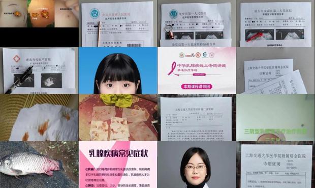 汕头乳腺流血水是什么病