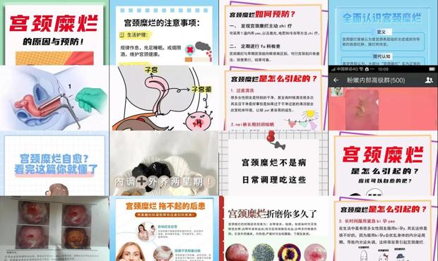 汕头宫颈糜烂怎么自愈
