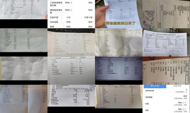 汕头白带常规检查