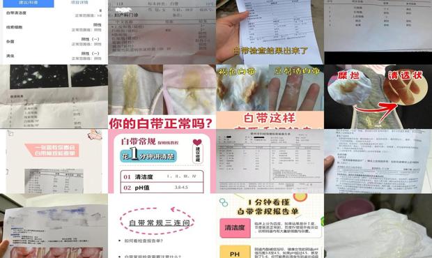汕头无检查白带*做宫颈活检关系大不大
