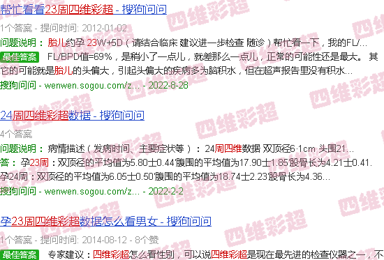 汕头胎儿23周四维彩超