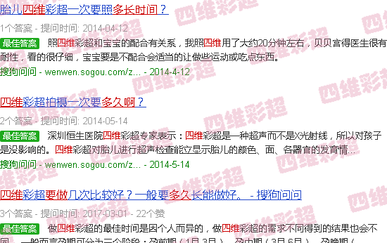 汕头四维要做多久啊