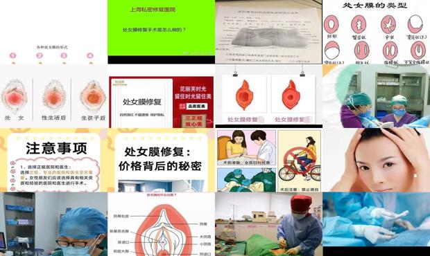 汕头做处女修复手术多少钱