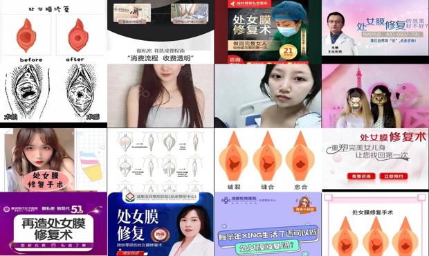 汕头修复处女