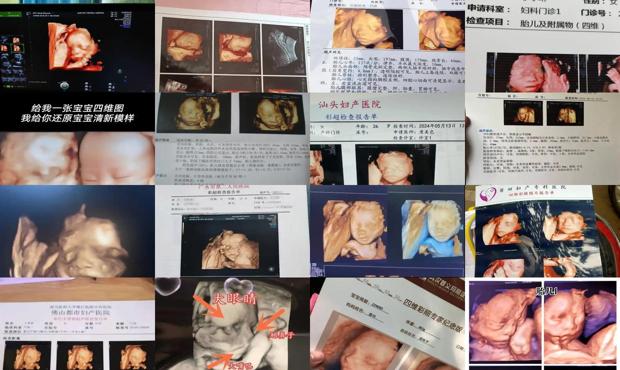 汕头四维彩超女孩生下男孩