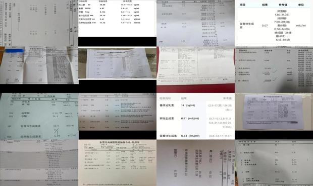 汕头激素六项检查是什么