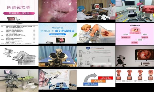 汕头阴道镜检查叫什么科