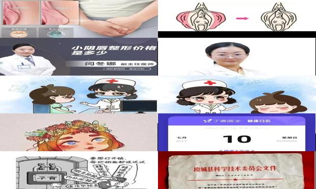 汕头阴唇肥大会不孕么