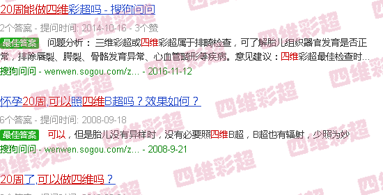 汕头20周可以做四维吗
