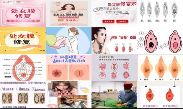 汕头处女模修复疼不疼